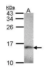 Anti-NDUFA5 antibody [N1C3] used in Western Blot (WB). GTX111016