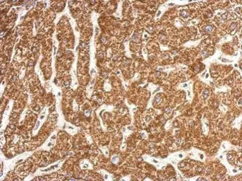 Anti-NDUFB4 antibody used in IHC (Paraffin sections) (IHC-P). GTX111026