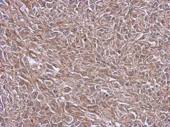 Anti-NDUFB4 antibody used in IHC (Paraffin sections) (IHC-P). GTX111026