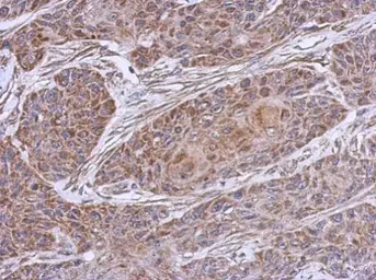 Anti-NDUFB4 antibody used in IHC (Paraffin sections) (IHC-P). GTX111026