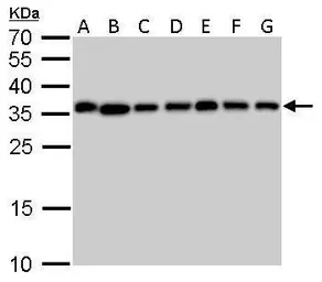 Anti-PPA1 antibody used in Western Blot (WB). GTX111031