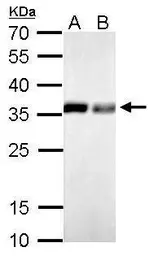 Anti-PPA1 antibody used in Western Blot (WB). GTX111031