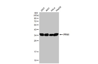 Anti-PPA1 antibody used in Western Blot (WB). GTX111031