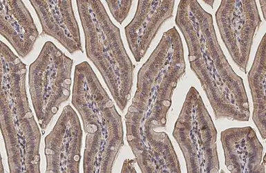 Anti-PPA1 antibody used in IHC (Paraffin sections) (IHC-P). GTX111031