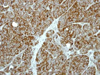 Anti-MP1 antibody [N1C3] used in IHC (Paraffin sections) (IHC-P). GTX111032