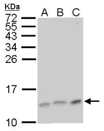 Anti-MP1 antibody [N1C3] used in Western Blot (WB). GTX111032