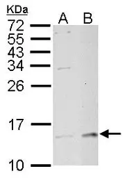 Anti-MP1 antibody [N1C3] used in Western Blot (WB). GTX111032