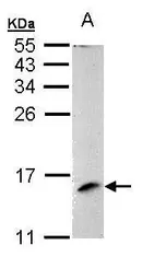 Anti-MP1 antibody [N1C3] used in Western Blot (WB). GTX111032