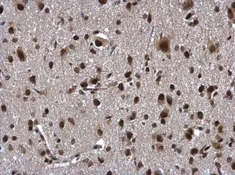 Anti-ZNF346 antibody [N1C3] used in IHC (Paraffin sections) (IHC-P). GTX111035