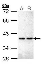 Anti-ZNF346 antibody [N1C3] used in Western Blot (WB). GTX111035
