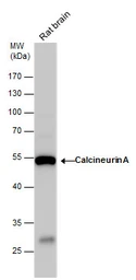 Anti-Calcineurin A antibody used in Western Blot (WB). GTX111039