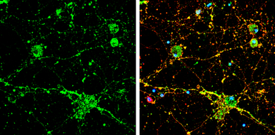 Anti-Calcineurin A antibody used in Immunocytochemistry/ Immunofluorescence (ICC/IF). GTX111039