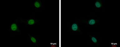 Anti-PLZF antibody [N1N3] used in Immunocytochemistry/ Immunofluorescence (ICC/IF). GTX111046