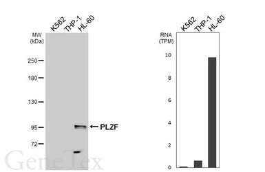 Anti-PLZF antibody [N1N3] used in Western Blot (WB). GTX111046