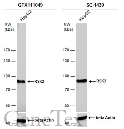 Anti-RSK2 antibody used in Western Blot (WB). GTX111049