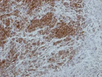 Anti-p90 RSK1 antibody used in IHC (Paraffin sections) (IHC-P). GTX111050