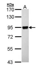 Anti-p90 RSK1 antibody used in Western Blot (WB). GTX111050