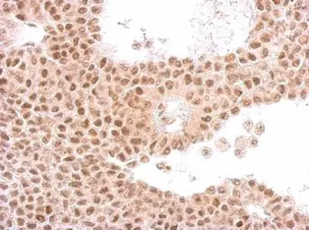 Anti-CDC23 antibody [N2C2], Internal used in IHC (Paraffin sections) (IHC-P). GTX111065