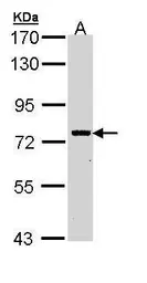 Anti-RIP antibody used in Western Blot (WB). GTX111074