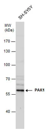 Anti-PAK1 antibody [N2C2], Internal used in Western Blot (WB). GTX111076