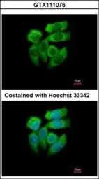 Anti-PAK1 antibody [N2C2], Internal used in Immunocytochemistry/ Immunofluorescence (ICC/IF). GTX111076