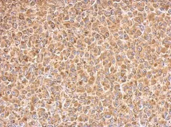 Anti-PAK1 antibody [N2C2], Internal used in IHC (Paraffin sections) (IHC-P). GTX111076
