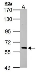Anti-PAK1 antibody [N2C2], Internal used in Western Blot (WB). GTX111076