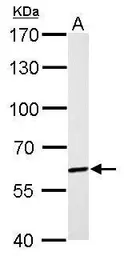 Anti-PAK1 antibody [N2C2], Internal used in Western Blot (WB). GTX111076