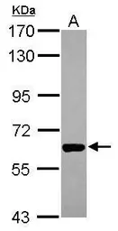 Anti-PAK1 antibody [N2C2], Internal used in Western Blot (WB). GTX111076
