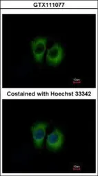 Anti-TID1 antibody [N3C3] used in Immunocytochemistry/ Immunofluorescence (ICC/IF). GTX111077