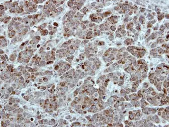 Anti-TID1 antibody [N3C3] used in IHC (Paraffin sections) (IHC-P). GTX111077