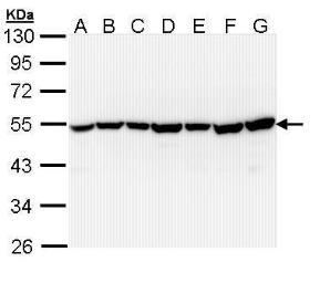 Anti-TID1 antibody [N3C3] used in Western Blot (WB). GTX111077