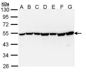 Anti-TID1 antibody [N3C3] used in Western Blot (WB). GTX111077