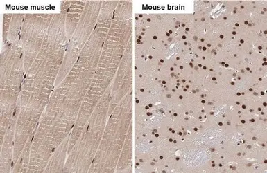 Anti-SRF antibody used in IHC (Paraffin sections) (IHC-P). GTX111085