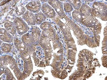 Anti-alpha 1 Catenin antibody [N3C2], Internal used in IHC (Paraffin sections) (IHC-P). GTX111095