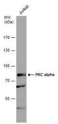Anti-PKC alpha antibody [C1C3] used in Western Blot (WB). GTX111096