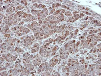 Anti-PKC alpha antibody [C1C3] used in IHC (Paraffin sections) (IHC-P). GTX111096