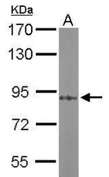 Anti-PKC alpha antibody [C1C3] used in Western Blot (WB). GTX111096