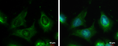 Anti-MAP3K13 antibody used in Immunocytochemistry/ Immunofluorescence (ICC/IF). GTX111101