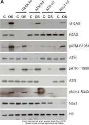 Anti-ATM antibody used in Western Blot (WB). GTX111106
