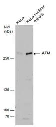 Anti-ATM antibody used in Western Blot (WB). GTX111106