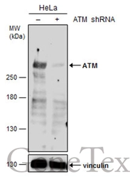 Anti-ATM antibody used in Western Blot (WB). GTX111106