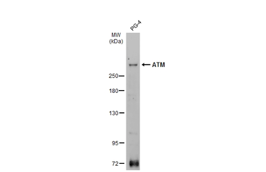 Anti-ATM antibody used in Western Blot (WB). GTX111106
