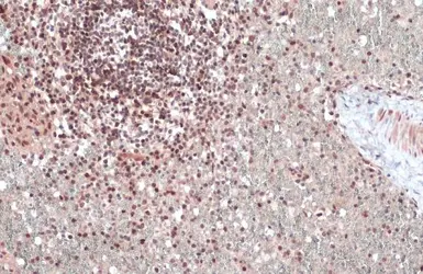 Anti-ATM antibody used in IHC (Paraffin sections) (IHC-P). GTX111106