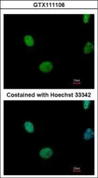 Anti-ATM antibody used in Immunocytochemistry/ Immunofluorescence (ICC/IF). GTX111106