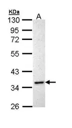 Anti-Inhibin alpha antibody [N2C3] used in Western Blot (WB). GTX111109