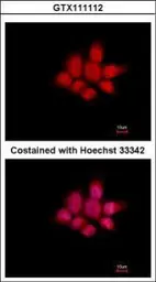 Anti-NCK1 antibody used in Immunocytochemistry/ Immunofluorescence (ICC/IF). GTX111112