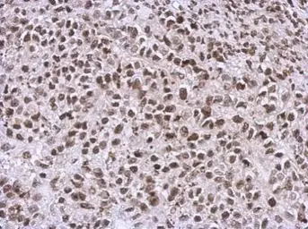 Anti-NCK1 antibody used in IHC (Paraffin sections) (IHC-P). GTX111112
