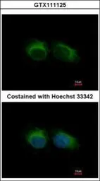 Anti-HIPPI antibody [C1C3] used in Immunocytochemistry/ Immunofluorescence (ICC/IF). GTX111125