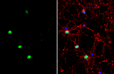 Anti-MEF2C antibody used in Immunocytochemistry/ Immunofluorescence (ICC/IF). GTX111134